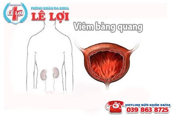 Nguyên nhân của bệnh viêm bàng quang