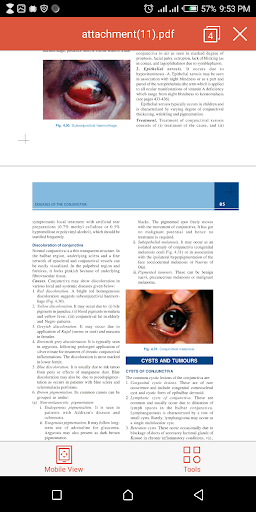 Ophthalmology Review - Comprehensive Ophthalmology