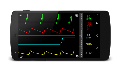 EKG Simulator