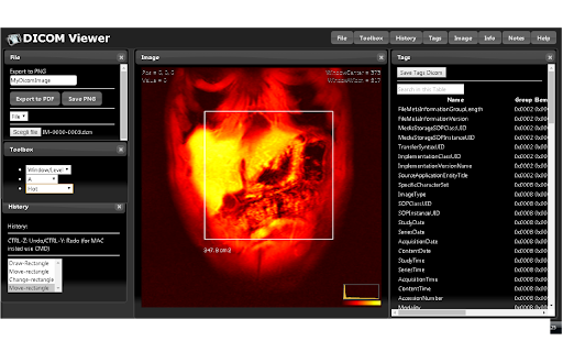 Dicom Image Viewer