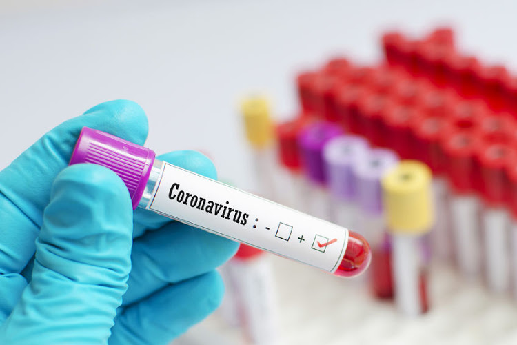 A negative test does not exclude Covid-19 infection as the test result depends on when a sample was collected and the quality of the sample collected. File image.