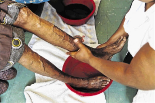 PAMPERED: An elderly woman enjoys a foot massage during Gogo Day 2013 celebrations at Lodirile Secondary School in Johannesburg Photo: LAUREN MULLIGAN