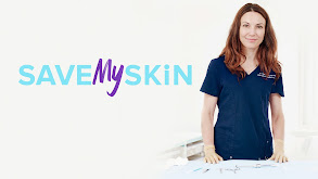 Save My Skin thumbnail