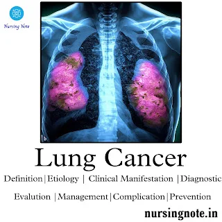 Lung Cancer : Definition,Etiology,Sign & Symptoms,Diagnosis,Treatment & Prevention