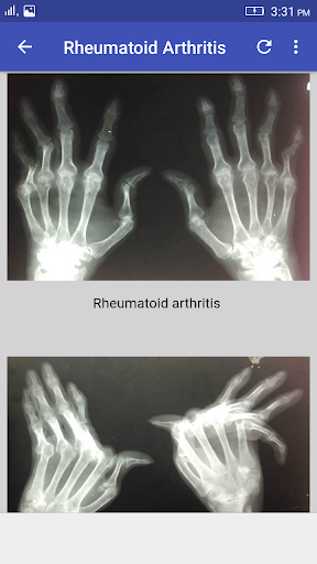 Musculoskeletal X- Rays Interpretation