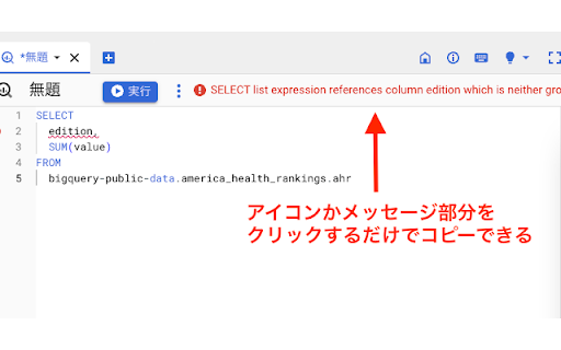 BigQuery console supporter