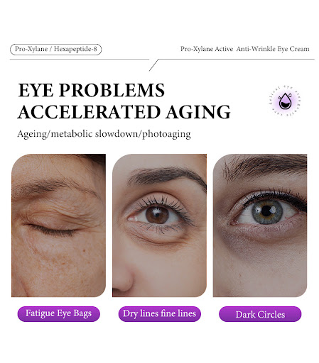 Title 2, Hyaluronic Acid Anti-Wrinkle Eye Cream Diminish...