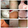 All Skin Infections & Treatments icon