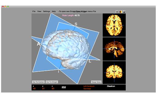 Dicom Medical Image Viewer