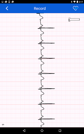 免費下載工具APP|iBP ECG app開箱文|APP開箱王