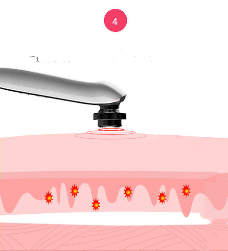 Title 11, Home Facial Radio Frequency Beauty Instrument t...