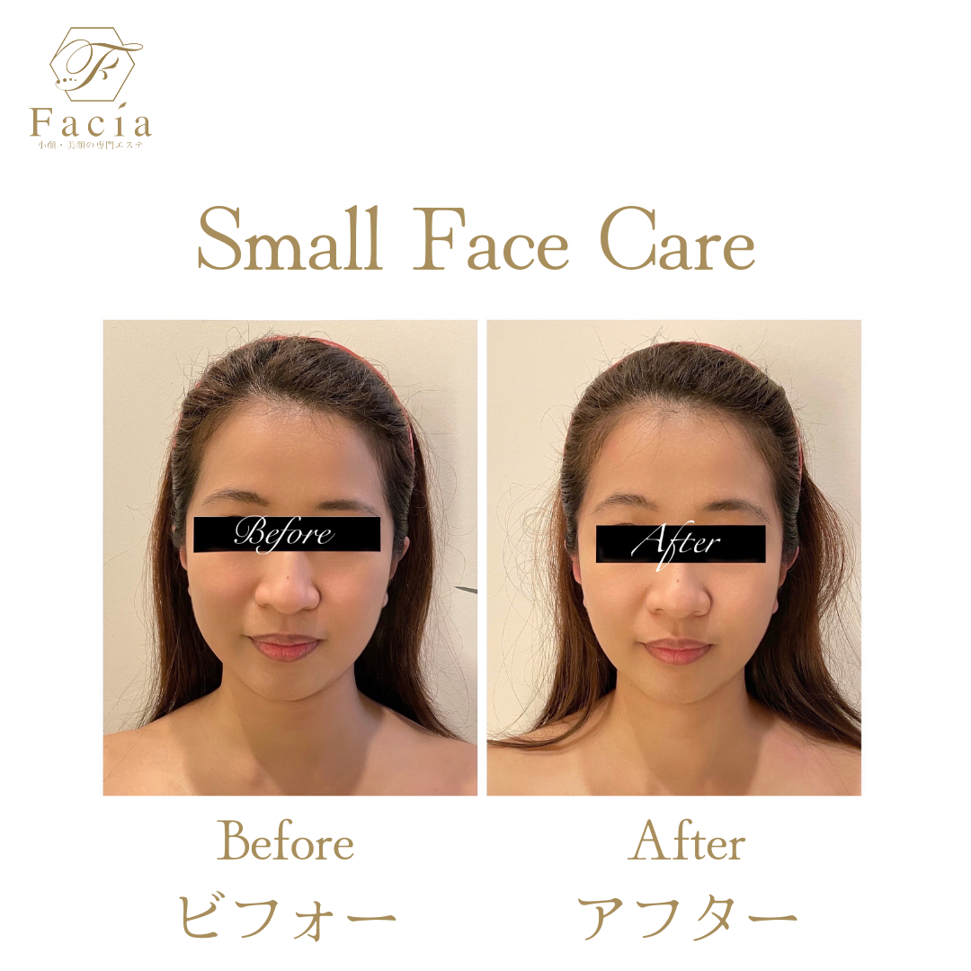 The Facia Ginza Premium Course: A Natural Path to a V-Shaped Face
