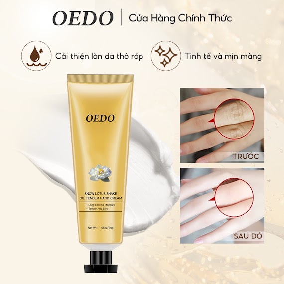 Kem Dưỡng Da Tay Oedo Tinh Chất Chống Lão Hóa Dưỡng Ẩm Chống Nhăn Mềm Da Giảm Khô Và Thô Ráp 30G