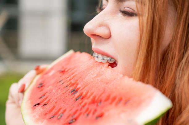 Close-up portrait of red-haired young woman with braces eating watermelon outdoors Close-up portrait of red-haired young woman with braces eating watermelon outdoors. invisalign eating stock pictures, royalty-free photos & images
