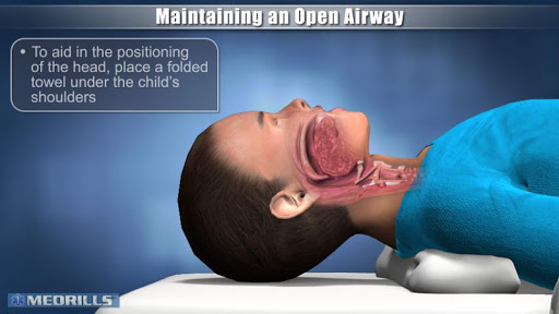 Medrills: Pediatric Airway