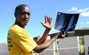 Employee Steven Molebatsi lost part of  his  fingers but says he was never compensated. 