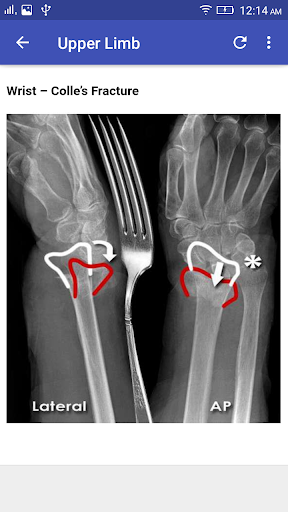 X-Ray Interpretation