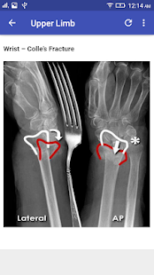 X-Ray Interpretation(圖8)-速報App