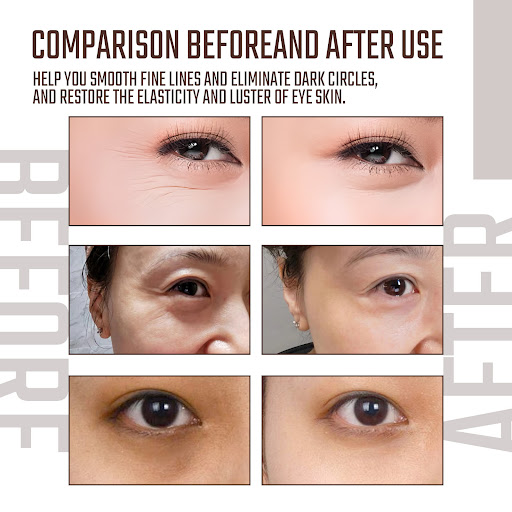 Title 6, Eye Fading Wrinkle Hydrating Skin Moisturizing ...
