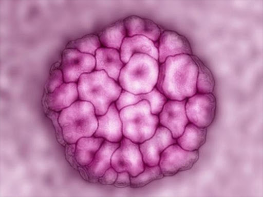 High-risk types of Human Papilloma Virus (HPV) can cause cervical cancer. /AGENCIES