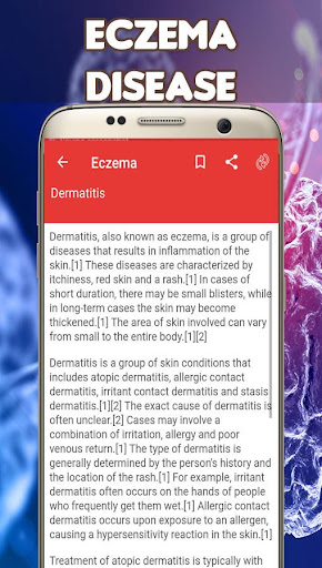 Eczema Causes, Diagnosis, and Management