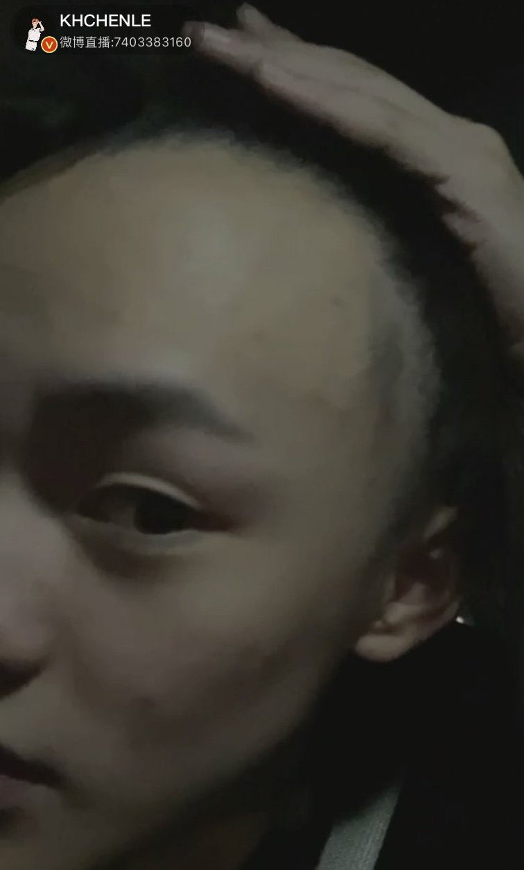 nct chenle weibo bald