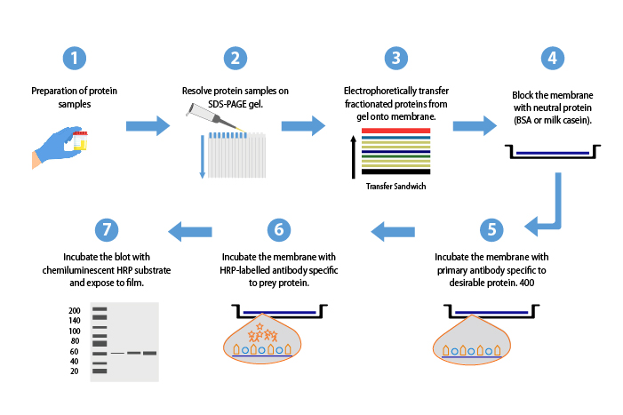 Flowchart Of Western Blot Procedure The Main Steps Of The Basic ...