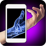 Cover Image of Download Xray Fracture Hand Prank 1.0 APK