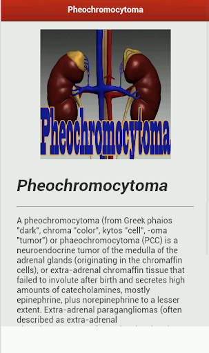 Pheochromocytoma