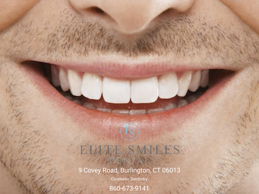 General Dentistry Burlington CT