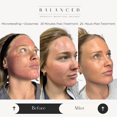 Clean, professional medical spa treatment room with neutral tones at Balanced Aesthetics, Weight Loss, & Wellness in Dublin
