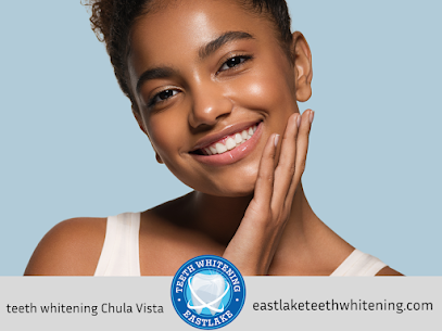 teeth whitening Chula Vista, CA