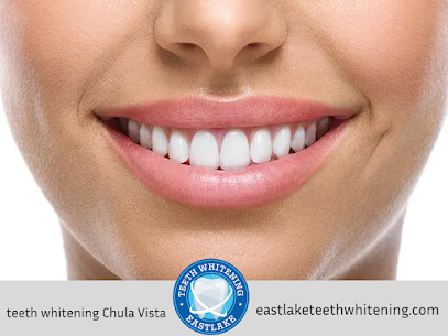 teeth whitening Chula Vista, CA