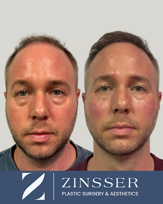 Clean, professional medical spa treatment room with neutral tones at Zinsser Plastic Surgery in Richmond