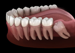Dentistry at the Cross 4