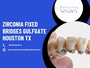 Dental Care and Implants of South East Houston (Formerly Known As: A Dental Care - Gulfgate) 5
