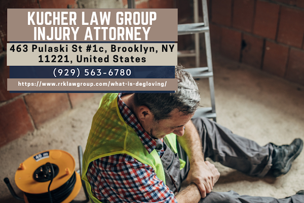 Kucher Law Group Urges Timely Action on NY Personal Injury Claims—3-Year Deadline is Critical for Your Rights