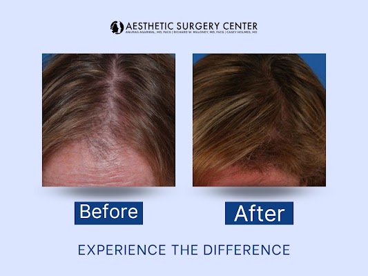 Clean, professional medical spa treatment room with neutral tones at Aesthetic Surgery Center in Naples