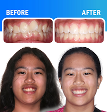 Montano Elevated Orthodontics 3
