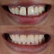 Smile Perfection Dental & Orthodontics of Royal Palm Beach 2