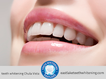 teeth whitening Chula Vista, CA
