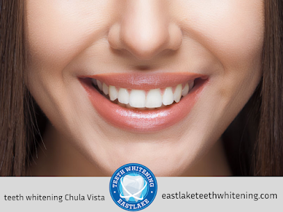 teeth whitening Chula Vista, CA