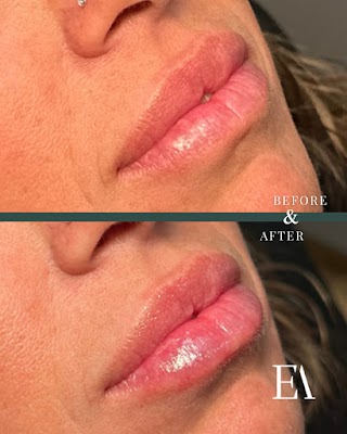 Clean, professional medical spa treatment room with neutral tones at The Edge Aesthetics And Company in Saint Augustine