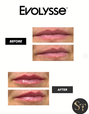 Clean, professional medical spa treatment room with neutral tones at Skin Tight Aesthetics And Wellness in Colgate