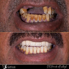 DAMAS DENTAL CLINIC EL MOHANDESSIN 3