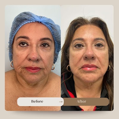 Clean, professional medical spa treatment room with neutral tones at Biostetix in Aventura