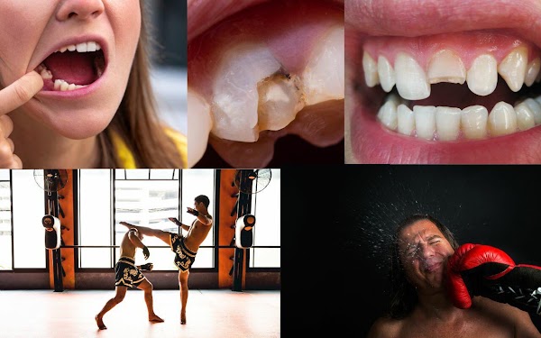 Central Valley Dentistry & Implants photo 1