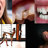 Central Valley Dentistry & Implants