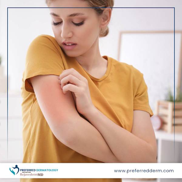 Preferred Dermatology - McKinney photo 1