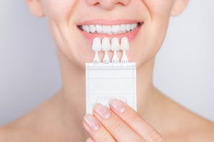 Dr. Nick Addario | Smile Expert 4